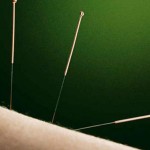 New Leaf – acunpuncture