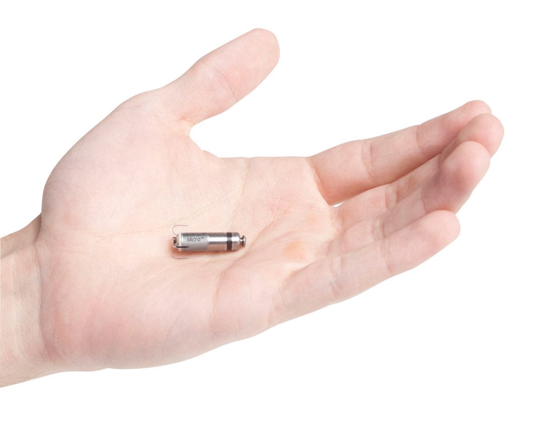 world's smallest pacemaker