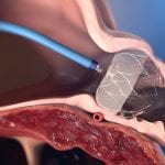 Product Photography – Anatomical (1)