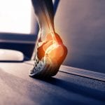 PeaceHealth-Ankle-Foot-Treatments
